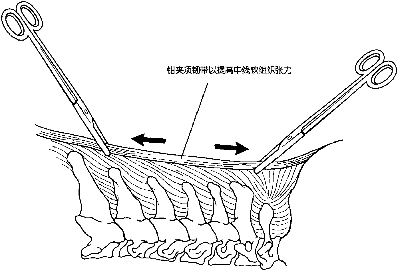 五、手術(shù)入路